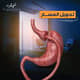 Slider image (10) Dr. Ahmed Yousry Clinic